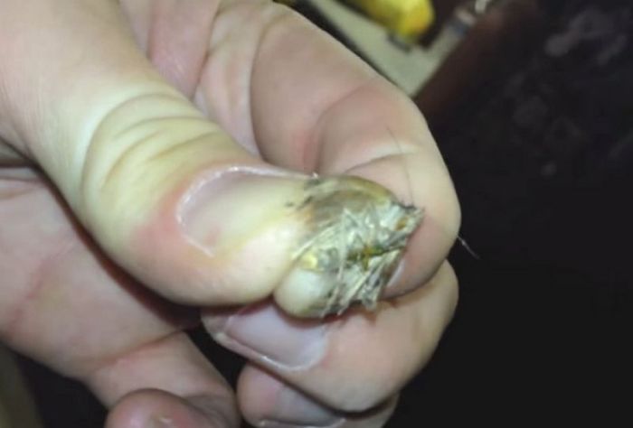 Шокирующие истории людей, внутри которых были найдены отвратительные насекомые насекомые внутри людей, существа внутри людей, личинки в телах людей