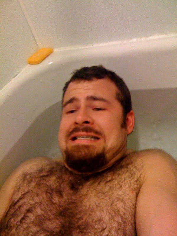 17 действенных советов, которые избавят вас от зуда после укусов комаров средства от зуда от укусов комаров, средства от комариных укусов, избавиться от зуда укус комаров, домашние средства от укусов комаров