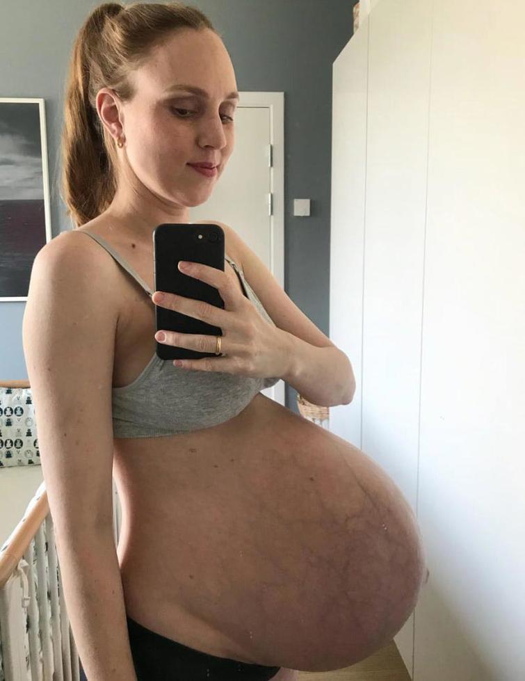 Реальные фото беременной