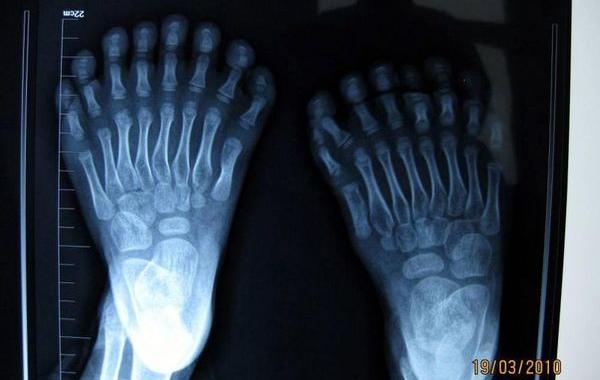 рентгену 120 лет, самые интересные рентгеновские снимки, шокирующие рентгеновские снимки