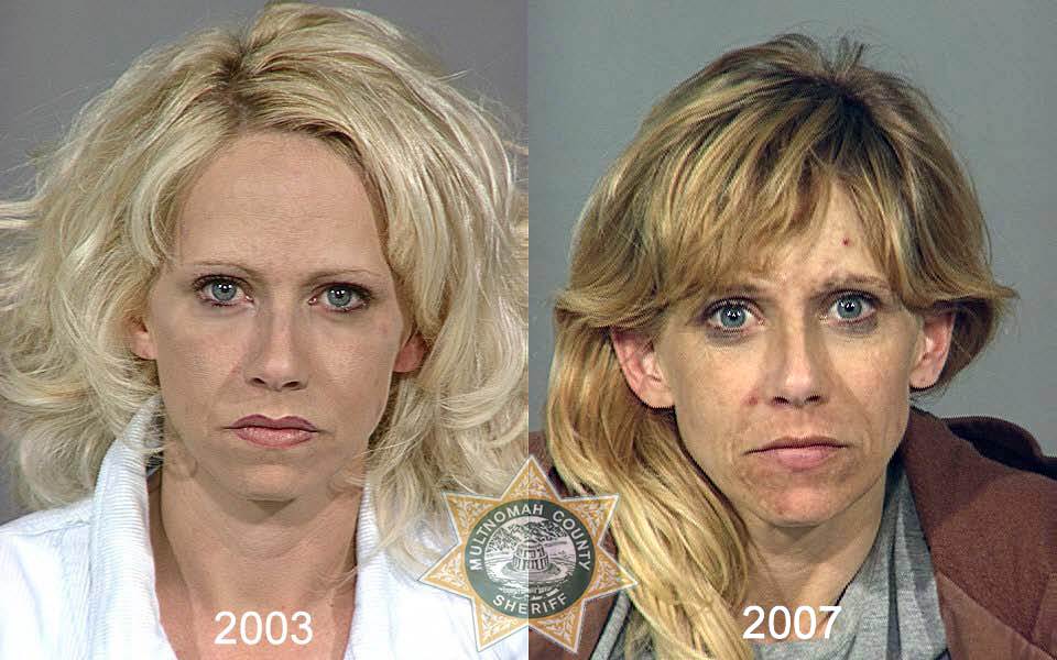 До и после принятия героина юра хой принимал наркотики