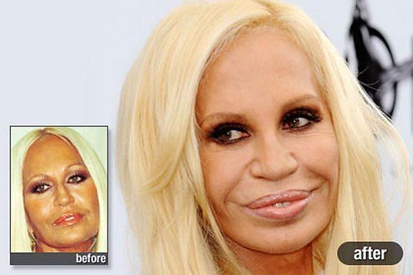 Жертвы пластической хирургии