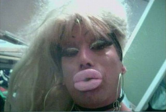 Жертвы пластической хирургии