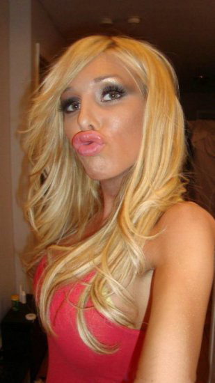 Жертвы пластической хирургии