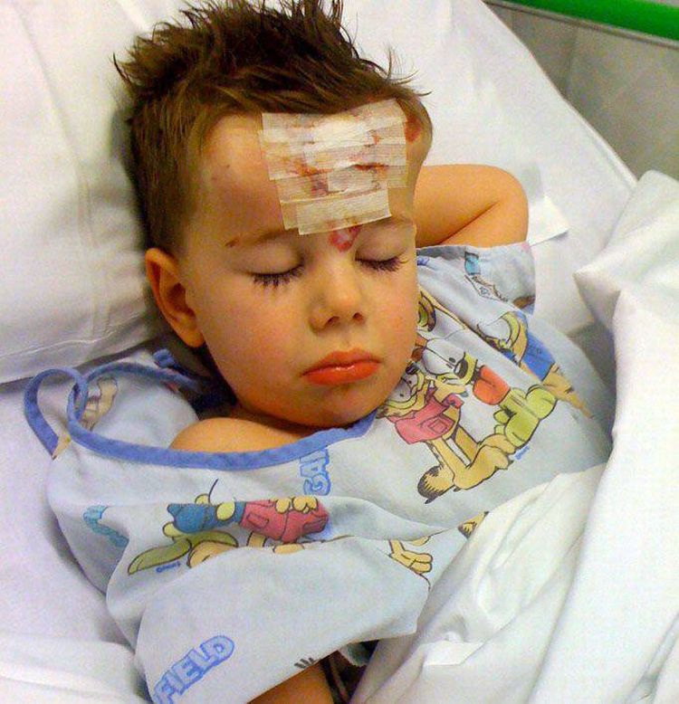 Ребенку, сделали ,операция, удаление, пятна