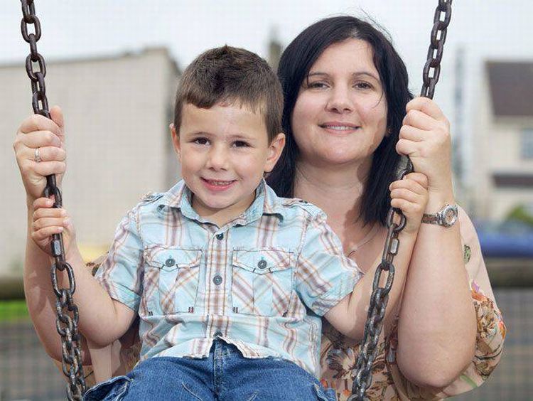 Ребенку, сделали ,операция, удаление, пятна