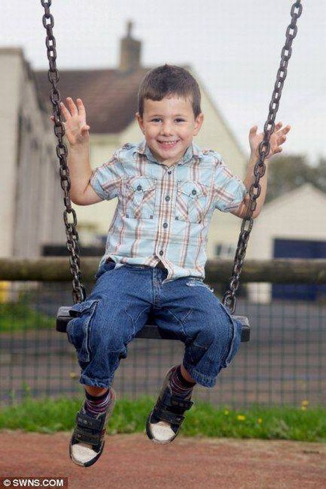 Ребенку, сделали ,операция, удаление, пятна