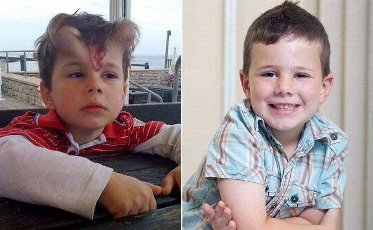 Ребенку, сделали ,операция, удаление, пятна