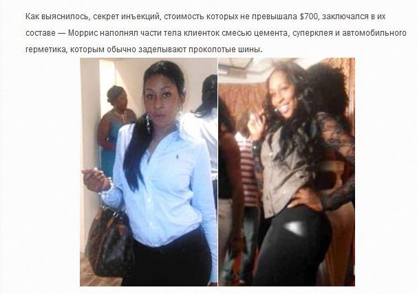 Ужасная красота. Жертвы пластической хирургии