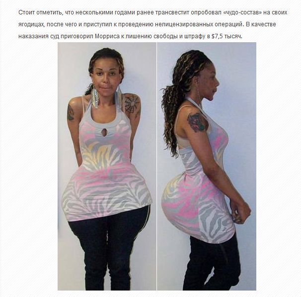 Ужасная красота. Жертвы пластической хирургии