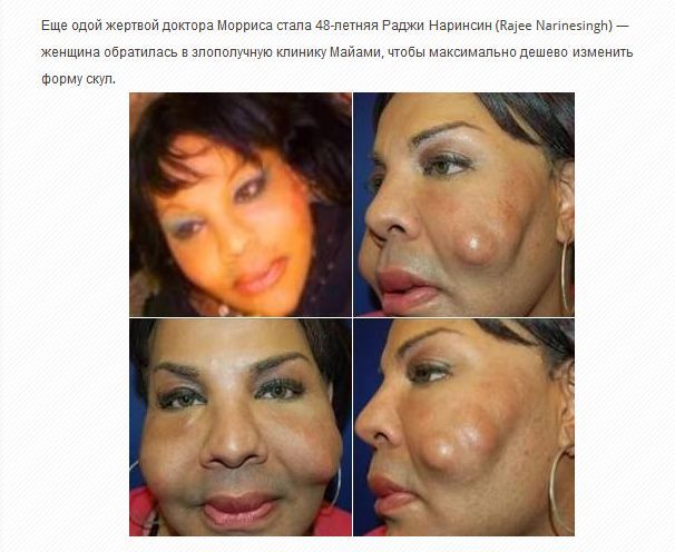 Ужасная красота. Жертвы пластической хирургии