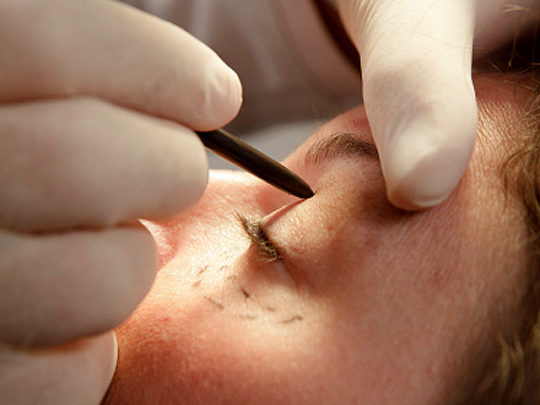 Топ самых популярных косметических процедур. Топ самых популярных косметических процедур.