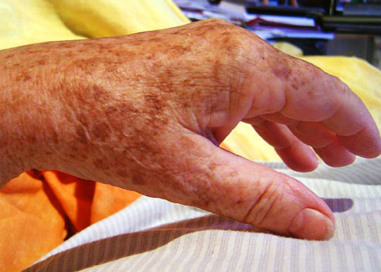 Топ самых популярных косметических процедур. Топ самых популярных косметических процедур.