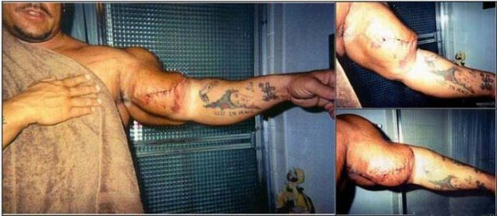 Качки - уроды. Жертвы синтола. Качки - уроды. Жертвы синтола.