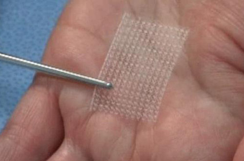 Самые необычные пластические операции