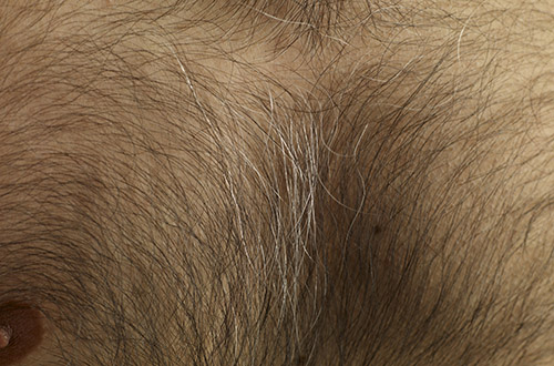 Самые необычные пластические операции