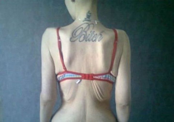 Толстая девушка похудела и заболела анорексией