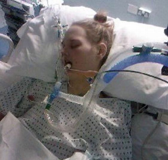 Толстая девушка похудела и заболела анорексией