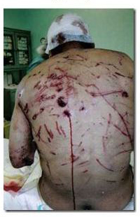 Они выжили. 10 историй о героическом выживании.