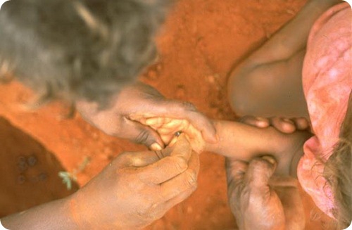 Медовые муравьи