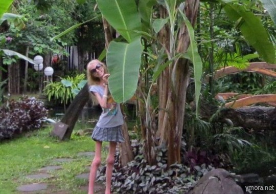 Последняя диета или анорексия