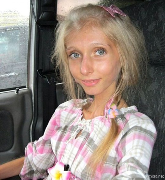 Последняя диета или анорексия