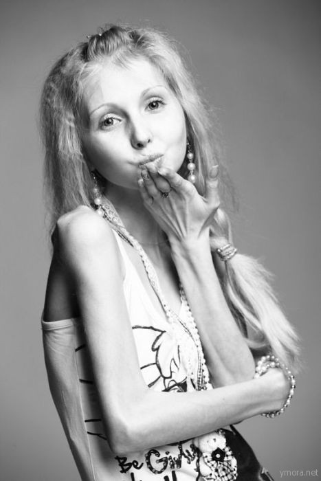 Последняя диета или анорексия