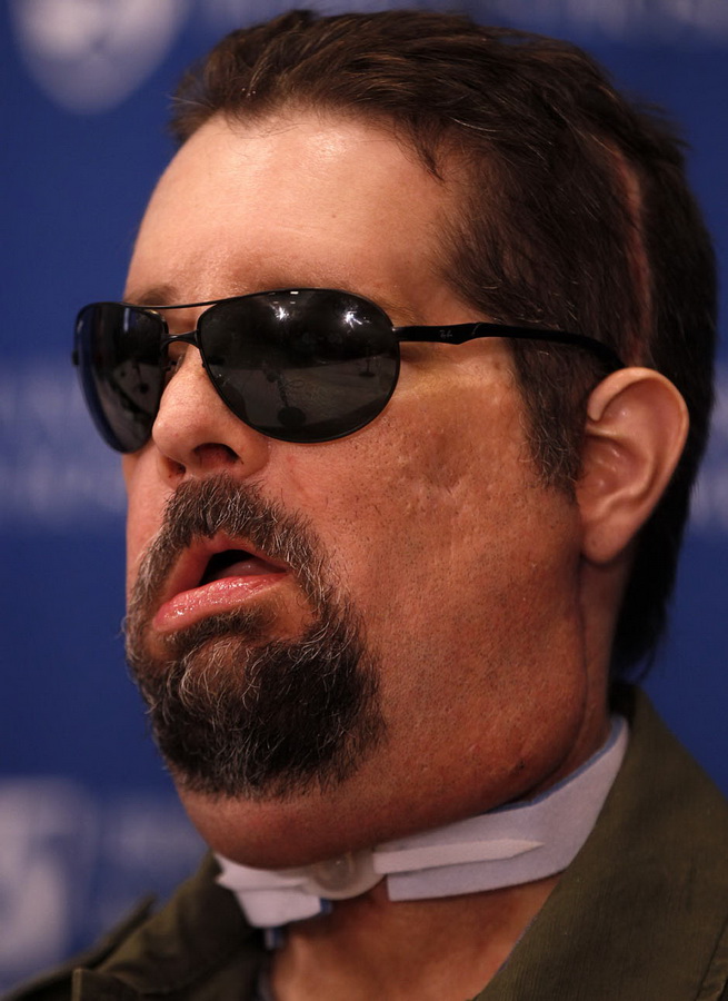 Человек без лица обрёл вторую жизнь