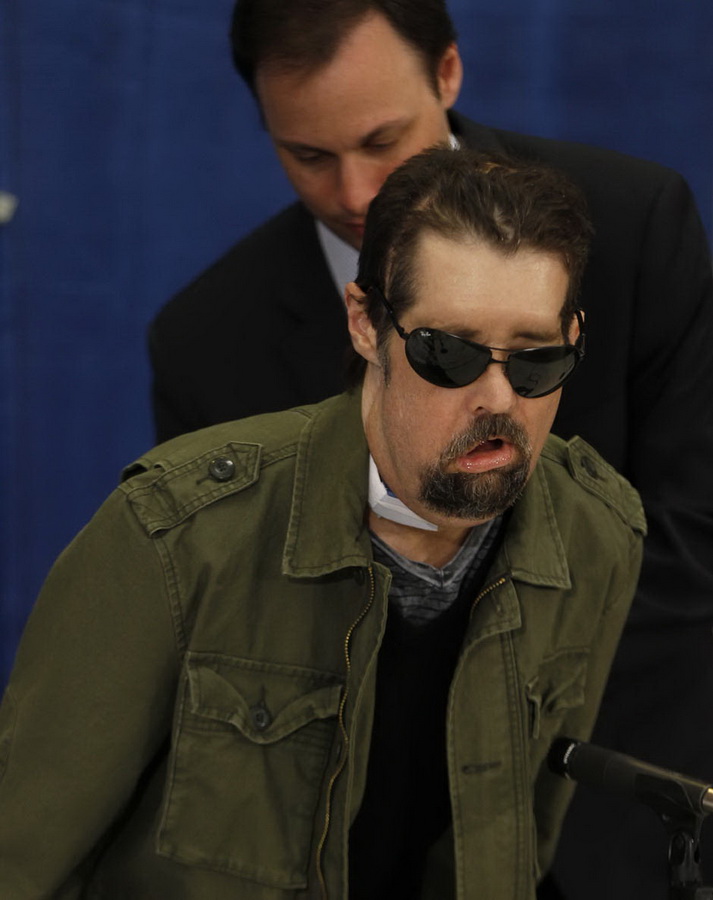 Человек без лица обрёл вторую жизнь