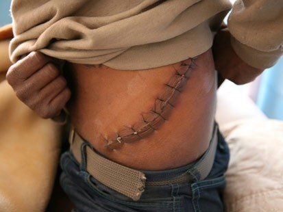 17-летний китаец обменял здоровье на смартфон и планшет