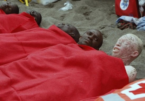 Тяжёлая жизнь африканских негров-альбиносов Тяжёлая жизнь африканских негров-альбиносов