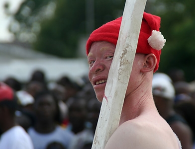 Тяжёлая жизнь африканских негров-альбиносов Тяжёлая жизнь африканских негров-альбиносов