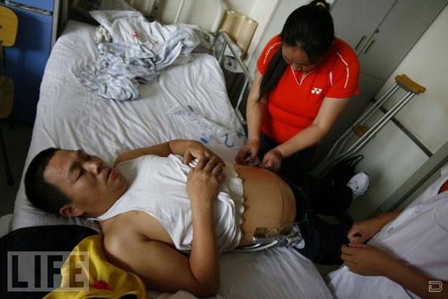 Настоящая сила воли и тяга к жизни Настоящая сила воли и тяга к жизни, человек пол тела