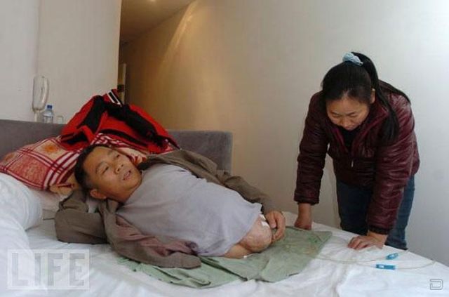 Настоящая сила воли и тяга к жизни Настоящая сила воли и тяга к жизни, человек пол тела