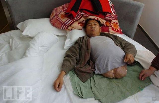 Настоящая сила воли и тяга к жизни Настоящая сила воли и тяга к жизни, человек пол тела