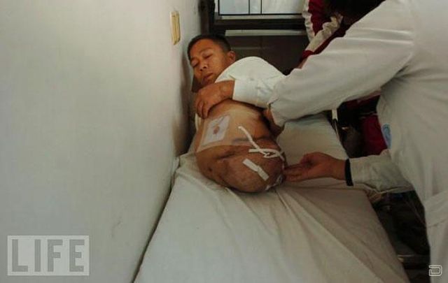 Настоящая сила воли и тяга к жизни Настоящая сила воли и тяга к жизни, человек пол тела