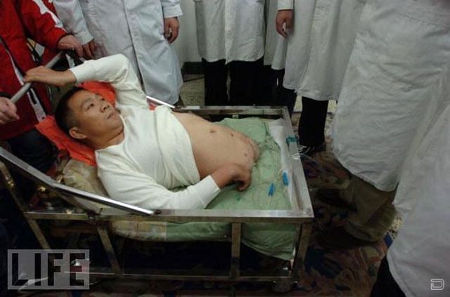 Настоящая сила воли и тяга к жизни Настоящая сила воли и тяга к жизни, человек пол тела