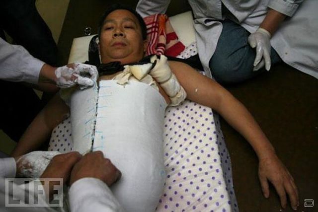 Настоящая сила воли и тяга к жизни Настоящая сила воли и тяга к жизни, человек пол тела