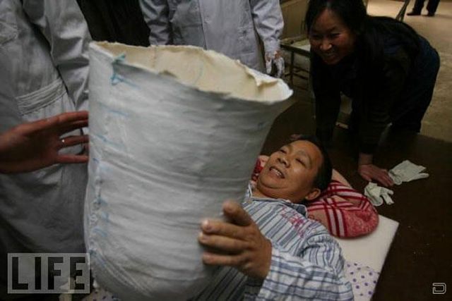 Настоящая сила воли и тяга к жизни Настоящая сила воли и тяга к жизни, человек пол тела