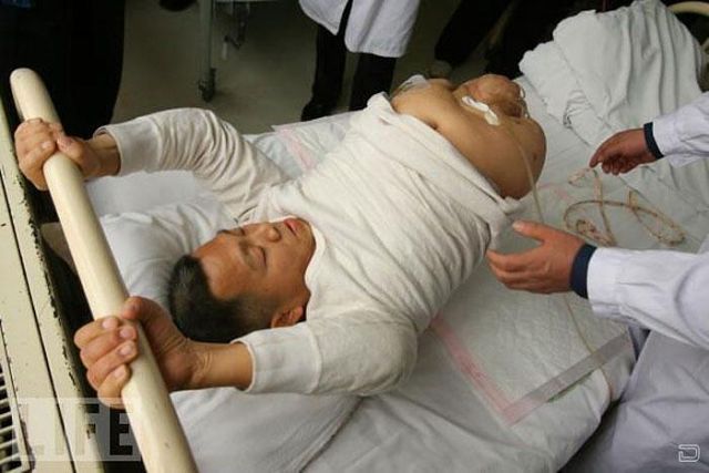 Настоящая сила воли и тяга к жизни Настоящая сила воли и тяга к жизни, человек пол тела