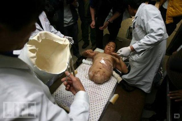 Настоящая сила воли и тяга к жизни Настоящая сила воли и тяга к жизни, человек пол тела