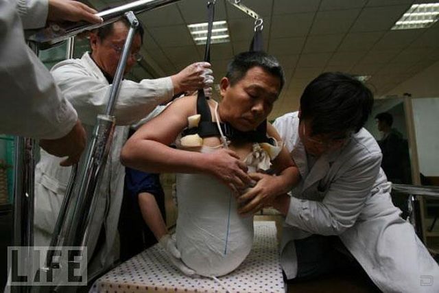 Настоящая сила воли и тяга к жизни Настоящая сила воли и тяга к жизни, человек пол тела