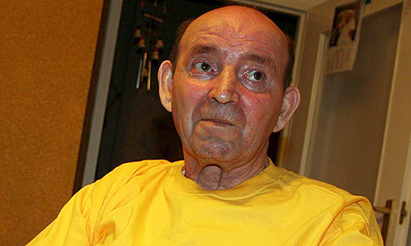 10 ошеломляющих медицинских историй