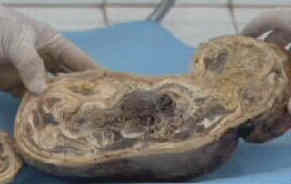 10 ошеломляющих медицинских историй