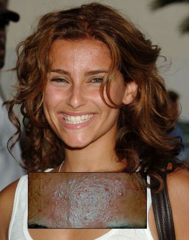 Крайне неудачные фото звезд