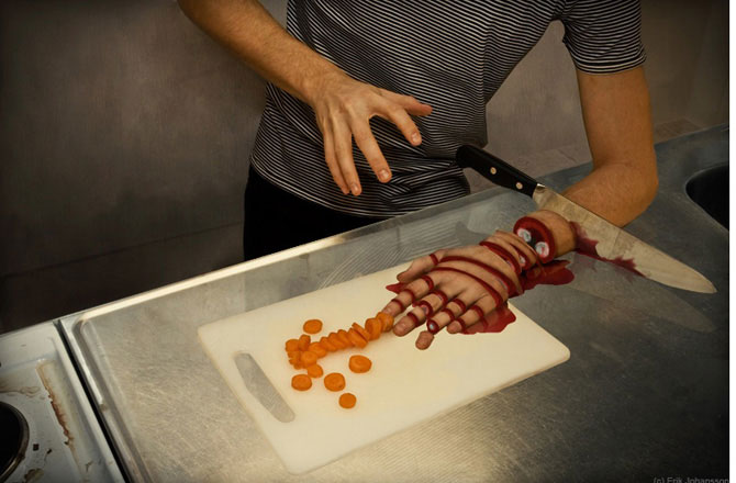 Самые необычные медицинские синдромы