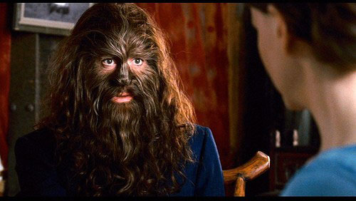 Самые необычные медицинские синдромы