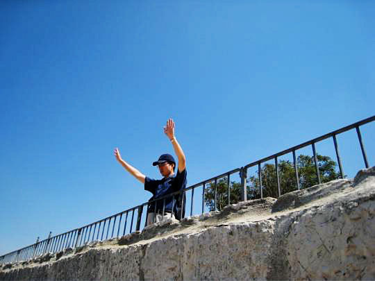 Самые необычные медицинские синдромы