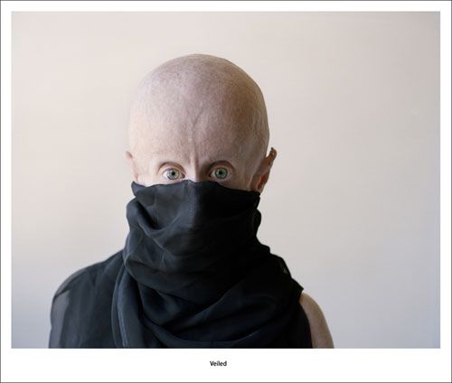 DJ Leon Botha и его страшная болезнь DJ Leon Botha и его страшная болезнь, прогерия