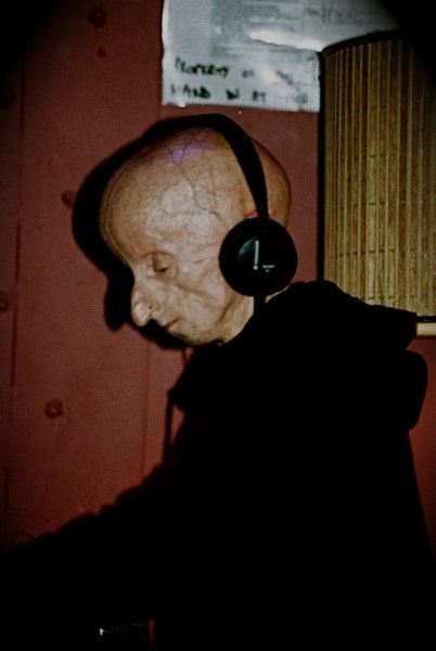 DJ Leon Botha и его страшная болезнь DJ Leon Botha и его страшная болезнь, прогерия